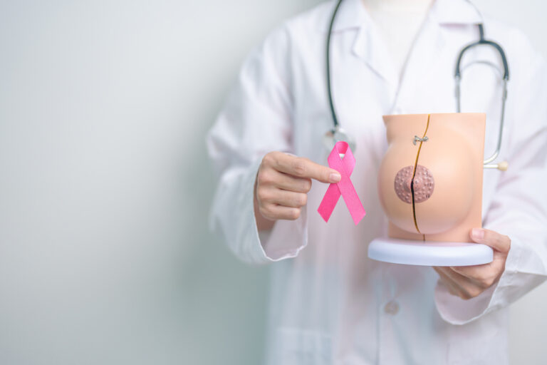 Cáncer de mama