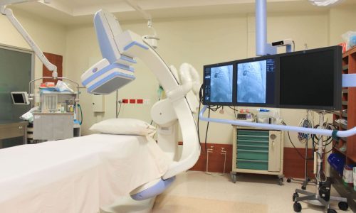 Angiografo-General-Electric-Innova-3100-IQ-scaled-1-r8a2ou2bxvihqsl3ot80aqgzzirbwbedllw72jvzjs