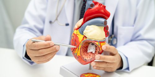 Cardiología avanzada