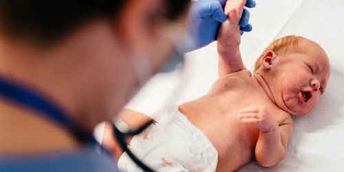 UCI Neonatal