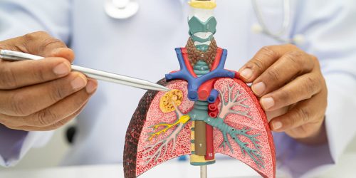 Unidad de Neumología